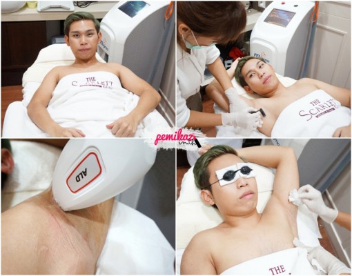 the-scarlett-clinic-laser-ipl-5