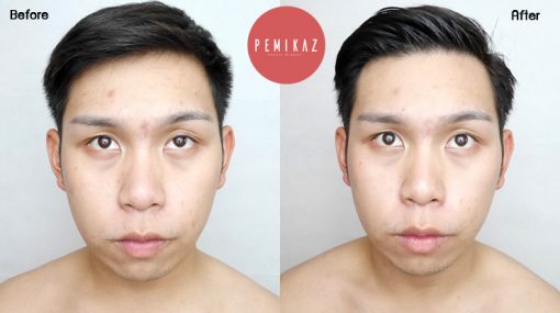 trends-skincare-before-after-1