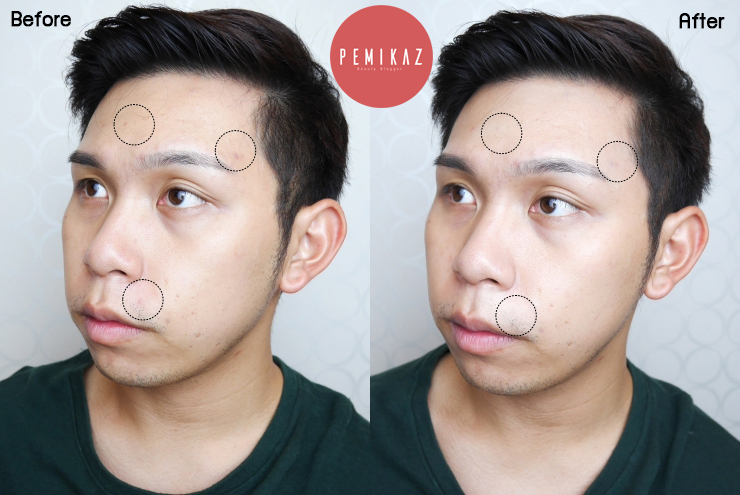 bk-retouch-acne-concealer1